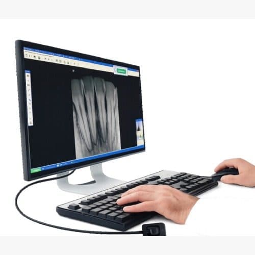 Digital Intraoral Sensor — photo 1